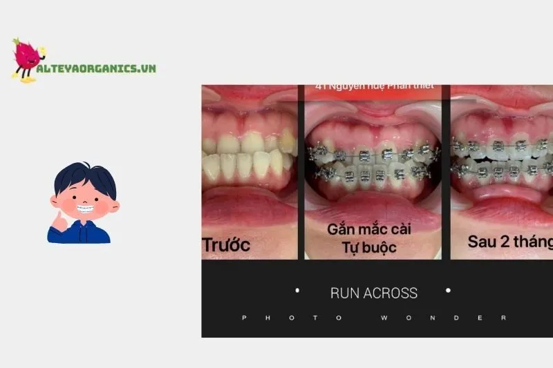 Nha Khoa Quốc Tế Smile