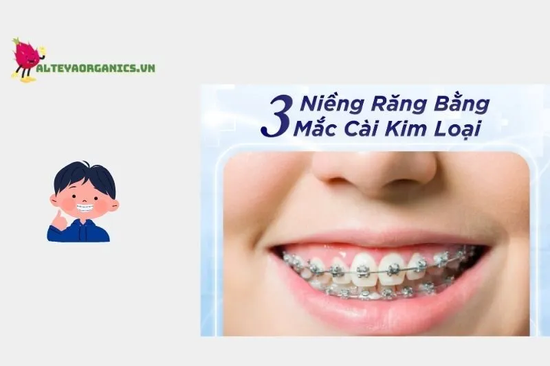 Top Địa Chỉ Niềng Răng Bình Thuận Hot Nhất